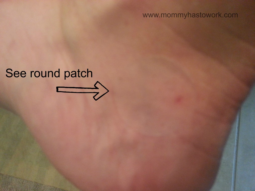 Skin Patch